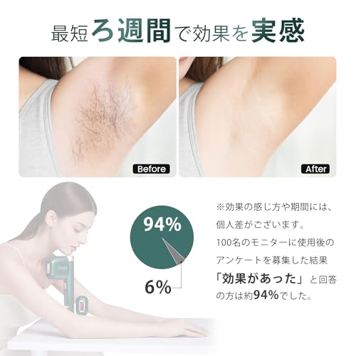 JOVS - JOVS Venus Pro Ⅱ脱毛器 の評価 | SHOPSTAFF